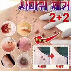 [당일배송] 미국기술 편평 제거 펜 피부 치료 제거 펜 손 발 치료 제거 액 크림 피부관리, 1개, 3ml