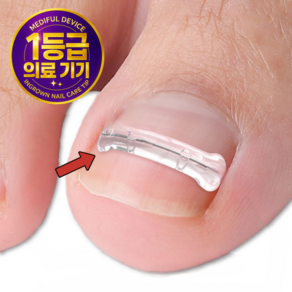 메디플 파고드는 발톱 케어 티타늄 탄성팁, 1개