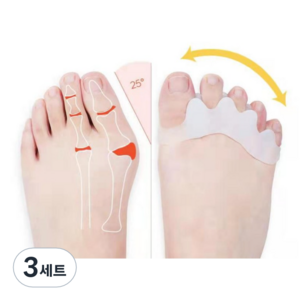비에스 정품 실리콘 발가락교정기 발가락링 2개입 무지 외반증 교정기 무지외반증 신발 여성화 무지외반증 실리콘 교정기무지 외반증 발가락 교정기 외출용, 3세트