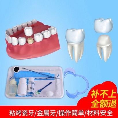 WEIYAN 치아접착제 구타 페르카 자가사용 에나멜 특수 접착제 틀니접착제 의치접착제