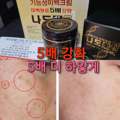 기미잡티제거 크림 /검버섯제거
