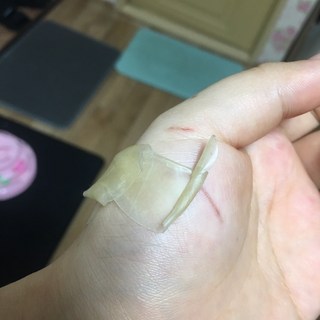 갤러리 이미지