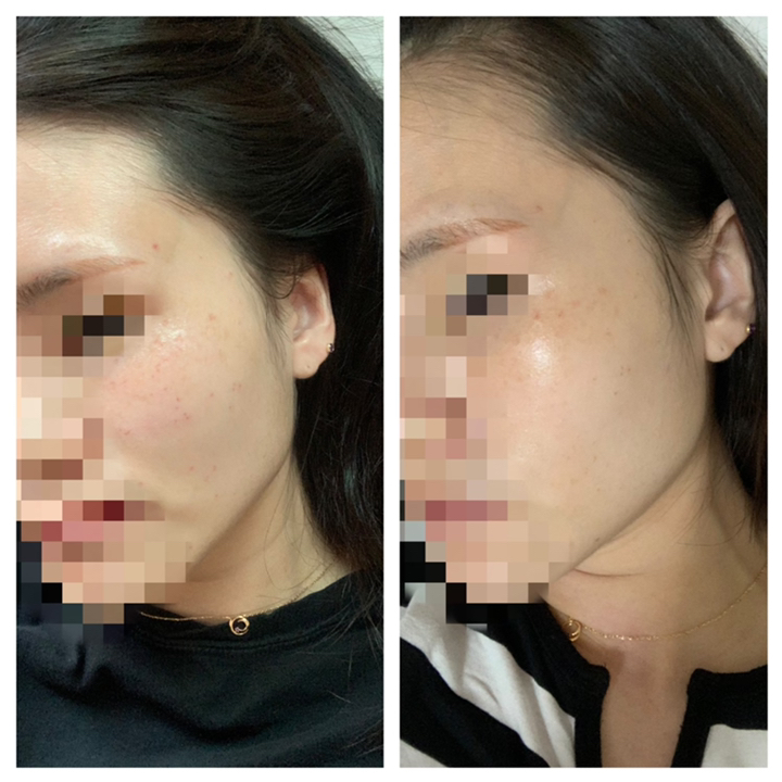 [2입기획] 미샤 니어스킨 마데카놀 크림 리뷰후기