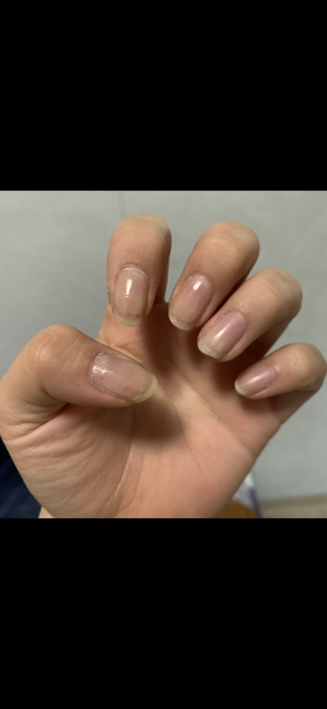 에코터치 세라믹 큐티클 리무버펜