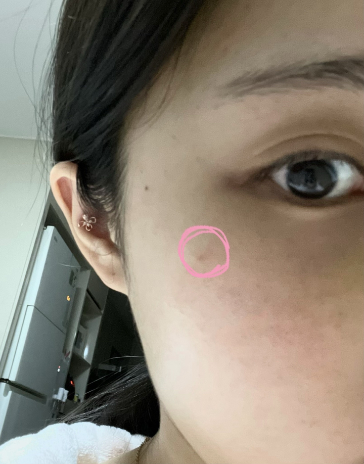 스킨알엑스랩 마데세라 더마식스 겔 리뷰 후기