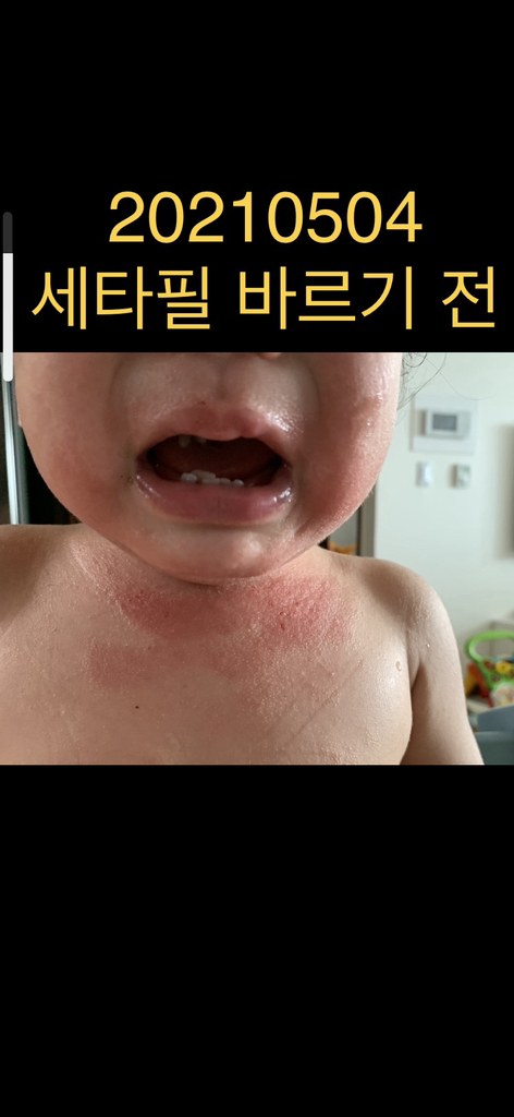 세타필 대용량크림 리뷰후기