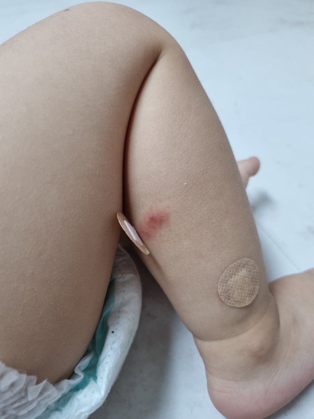 아텍스 메디랩 생활방수 스킨핏케어밴드 원형