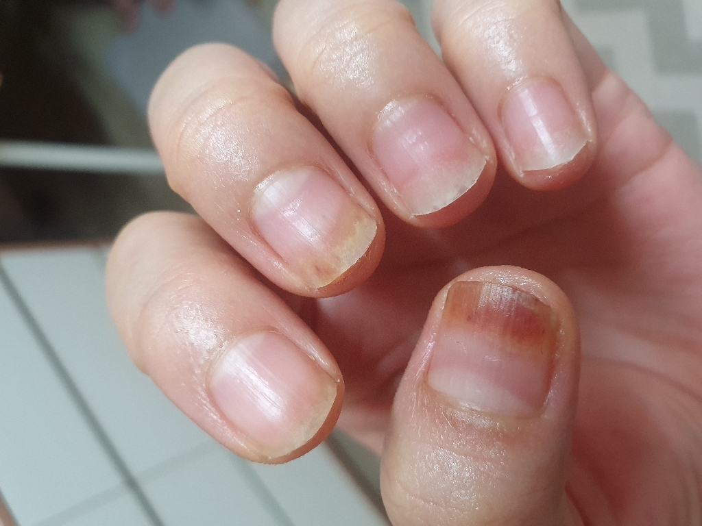 케라셀네일 손톱 발톱 영양제