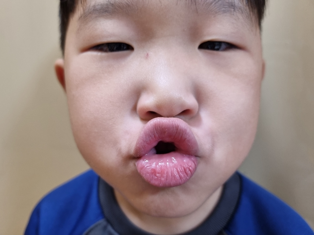 베르플로스 립밤