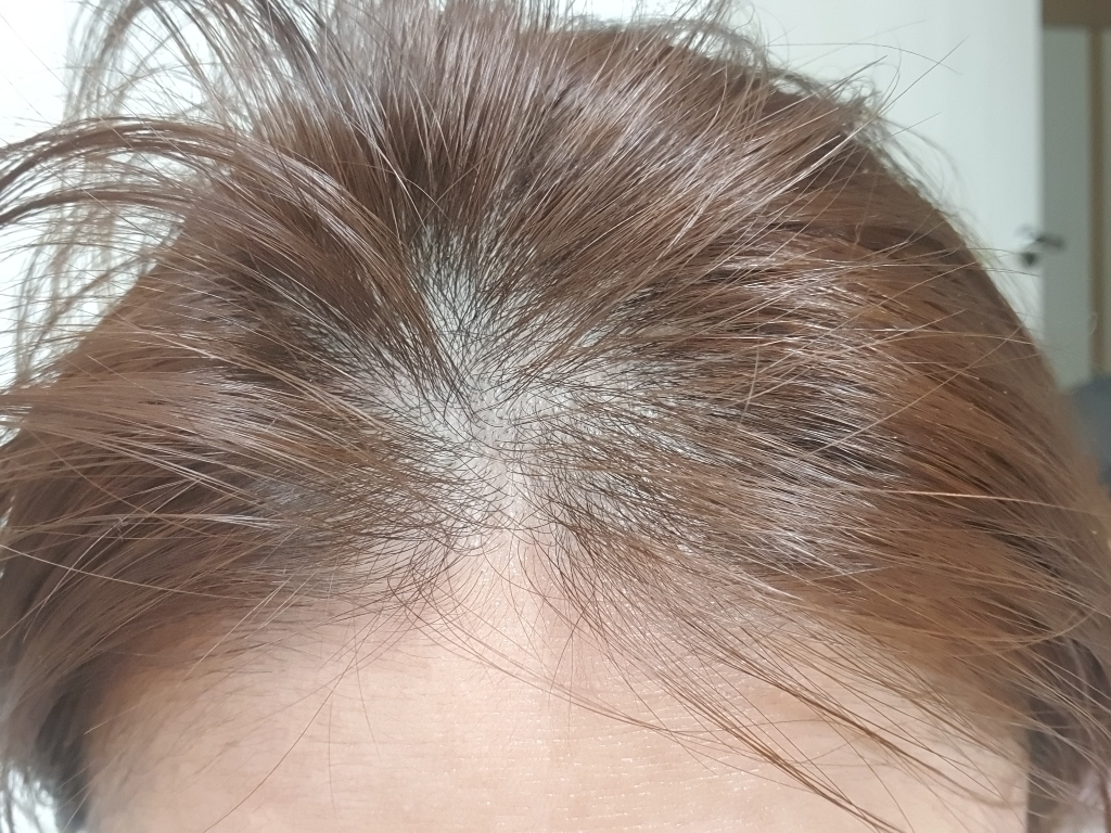 플루 프로페셔널 탈모 완화 샴푸