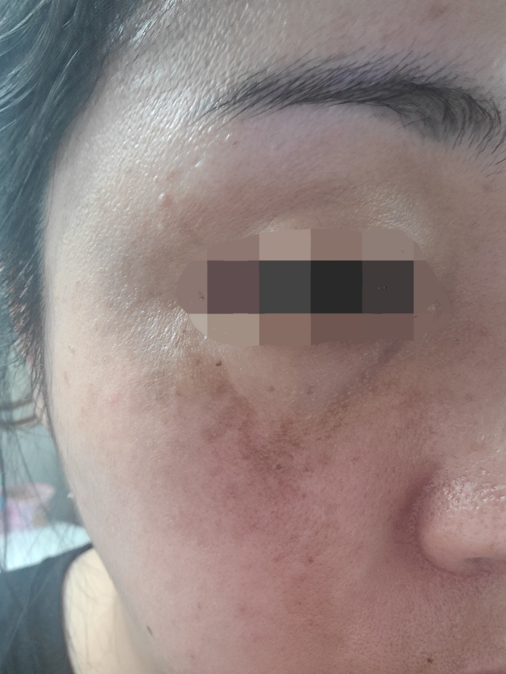 봄앤톡스 리프팅 팔자 주름 개선 펩타이드 줄기세포 세라마이드 재생 화장품 크림