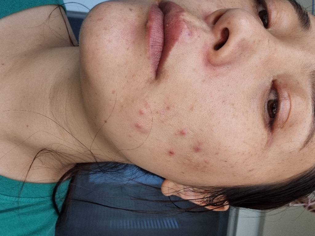 아누아 어성초 아크네 약산성 클렌징 폼