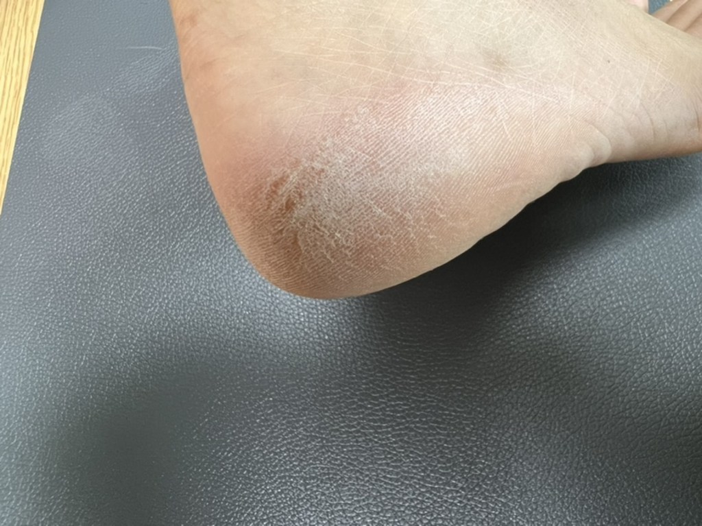 발프라이즈 전동 발각질 발뒤꿈치 각질 제거기 패디플래닝 풋파일 발각질제거기 전동발각질제거기 발뒤꿈치통증 발바닥굳은살제거 발굳은살제거 발뒤꿈치각질제거기 발뒤꿈치갈라짐 굳은살제거기