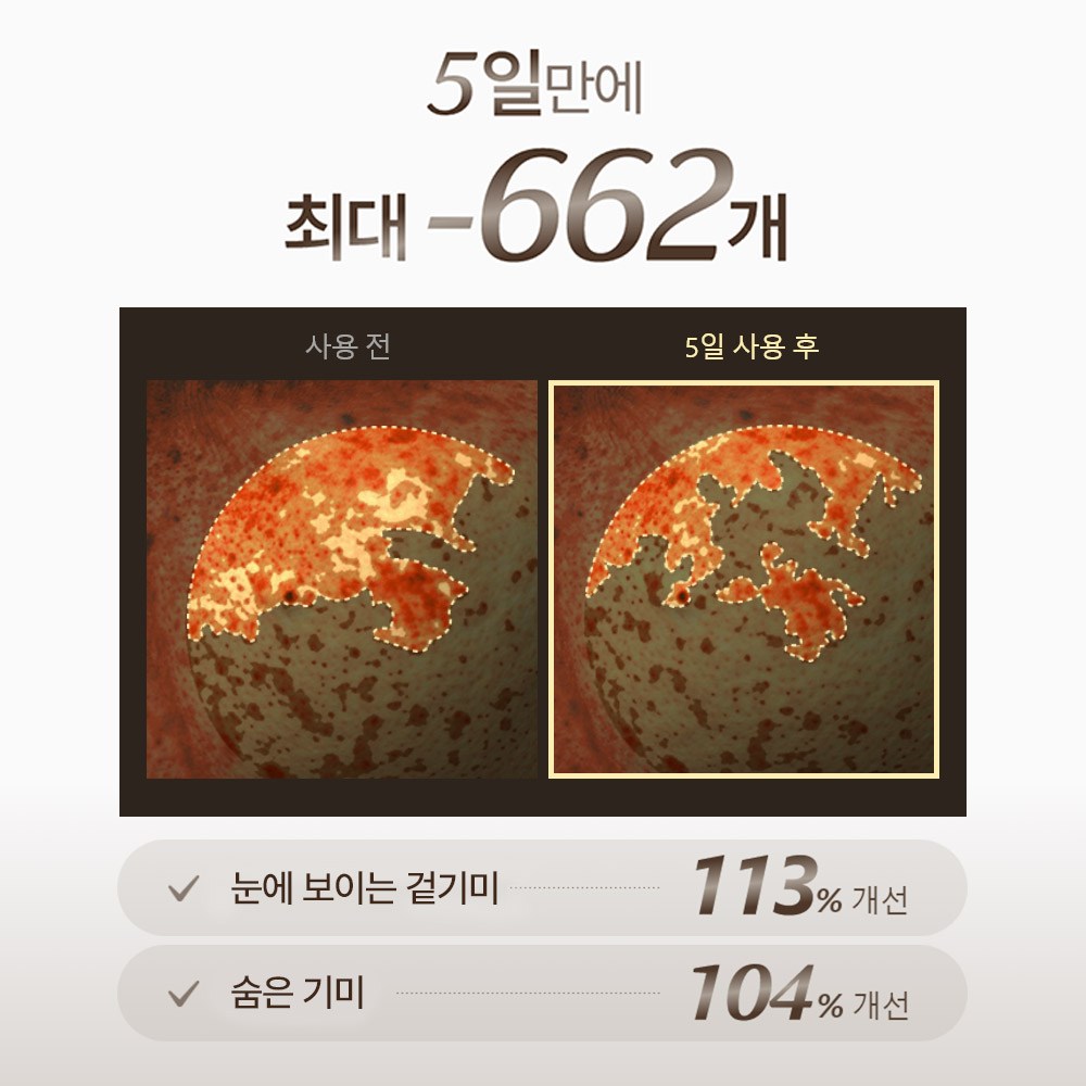 빛나는 피부를 위한 혁신적인 세트, 메디테라피 멜라쥬란 화이트 토닝 크림 + EMS 디바이스