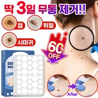 [빠른배송] 피부 제거 패치 얼굴 바디 피부 치료 라벨 스텔스 포장증정, 145매입, 2개