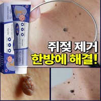 [국내배송] 1+1/2+2 미국 피부 치료 제거 연고 신속하고 효과적인 제거 스킨 제거 크림, 1개, 1개, 1개