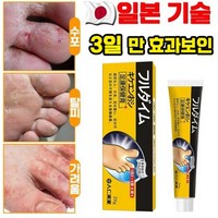 [국내배송] 일본 발 연고 발냄새 제거 발바닥 발가락 가려움 완화 연고 포장증정, 1개, 20g, 1개입