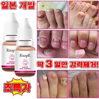 [당일 배송] 1+1/2+2 손톱 발톱 무좀 앰플 발톱 영양제 문제성 발톱 케어 효과보장/선물 랜덤 증정, 1개, 10ml