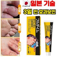 [국내배송] 일본 발 연고 발냄새 제거 발바닥 발가락 가려움 완화 연고 포장증정, 3개, 20g, 1개입