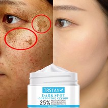 TRSTAY-미백 주근깨 크림 기미 진정 다크 스팟 멜라닌 기미 진정제 모이스처라이징 브라이트닝 페이스 스킨 케어, 01. 50g