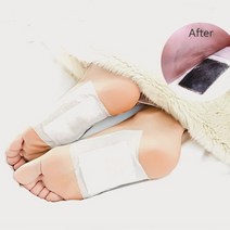 수액시트 20매 풋패치 발바닥통증 목초수액시트