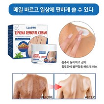 50g 딱딱하고 튀어난 지방종 개선 지방결절연고 지방종 연고 지방 연소 마사지 다발성 개선하다지방종/피하 덩어리/독립성 지방종/섬유종/분말종/낭종, 50g*2