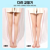 오다리 O자형 X자다리 교정기 휜다리 종아리성형, 어린이 디럭스] 발 외반+자석 2쌍
