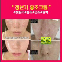 갱년기 홍조 크림 식물성 에스트로겐 크림 안면홍조 피부탄력 기미제거, 자신감형 홍조 크림 3개