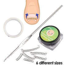 내성발톱 자가치료 내성발톱교정기 8 개/대 Ingrown Toe 네일 교정 와이어 픽서 페디큐어 복구 Paronychia, 한개옵션0