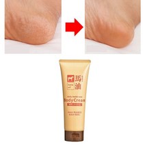 발 뒤꿈치 굳은살 발바닥 제거 갈라짐 연고 발건조 각질 용해제 연화 크림 껍질 벗겨짐