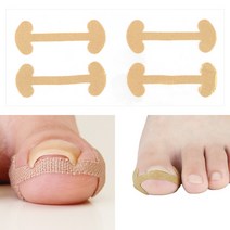 내성 발톱 교정 보호 테이프