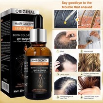 탈모약 탈모치료제 프로페시아 바르는 먹는탈모약 탈모샴푸 두피모낭염 30ml 비오틴 모발