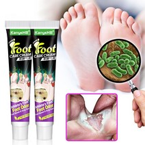 BT 무좀 치료 발가려움 연고 FOOT, 3개, 20g, 1개