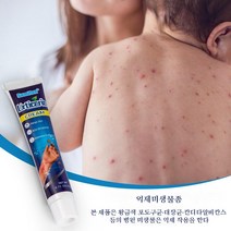Sumifun 1+1 두드러기 피부가려움증 두드러기 발진 지루성피부염 연고, 20g