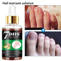 네일영양제 손 발 네일 톱 강화 케어 연화 제 영양 오일 네일 리페어 세럼 곰팡이 치료 손발톱 진균증 Par, 01 10ml