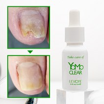 요모클리어 15ml 젤네일 손톱무좀 발톱무좀 발냄새 문제성 페디솔루션, 2개