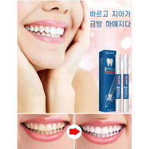 치아미백 젤 치아 누런 때 제거 브라이트닝 젤펜 치아 누런때 제거 (19g*2개/박스)*1/3, 박스(19g*2개/박스)*1