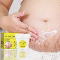 1 Pc 30g 완벽한 퍼밍 출산 흉터 여드름 크림 스트레치 마크 페이딩 총 지우기 Tumeric 무스 스킨 케어 수리 키트 뷰티