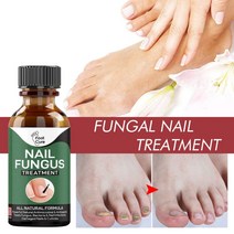 발톱레이저 셀프네일케어 손톱 발톱 발가락 곰팡이 치료 수리 20ml 솔루션 수정 손상 갱신 깨진 금이 변색 된 미용 건강 관리, [01] Nail Fungus Treat