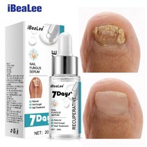 국내출하(당일발송) iBeaLee 발톱무좀 치료 발톱무좀 연고 발무좀연고 20ml