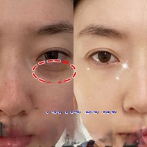 뷰티아이 백 아티팩트 남성용 에센스 다크 서클 패치 링 오일 여성 마스크, 한개옵션1, 04 756g