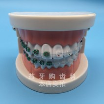 치아모형 교정 교정 모델 아치 와이어와 대조되는 금속 세라믹 브래킷 교육 의사 환자