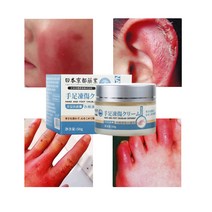 일본의 수입원료 동상연고 동상 치료 동상치료연고 발 뒤꿈치 갈라짐 손가락 갈라짐, 50g