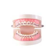 치과 교정 치아 모델 덴티폼 브라켓 세라믹 덴탈 소품, 금속 브라켓 모델