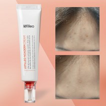 특허완료 항균 여드름 시카크림 무자극 레필레오 노아덤 천연유래 재생크림, 35ml