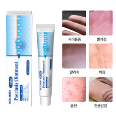 HEALMUSZ 촉성피부염 알러지 알레르기 피부연고 아토피상처 소양증 대상포진 백선연고 습진 A-04