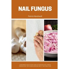 (영문도서) Nail Fungus: A Beginner's Quick Start Guide to Managing Nail Fungus Through Diet With Sample... Paperback, Mindplusfood, English, 9798869215055