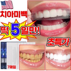 [국내배송] 미국 1/1+1/2+2 치아 미백 패치 셀프 치아미백 제 화이트닝 얼룩 제거 스티커, 1세트, 26g