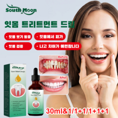 1/1+1 잇몸 보호 구강 케어 액체 구강 청결 케어 드롭제 세균 제거 구강의 건강을 지켜줌, 30ml, 2개, 30ml