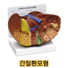 미국/간질환모형 G331/실제크기 보건교육